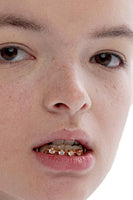 Gold Dental Collection Full Gem Lower Teeth Brace (single) - Dose